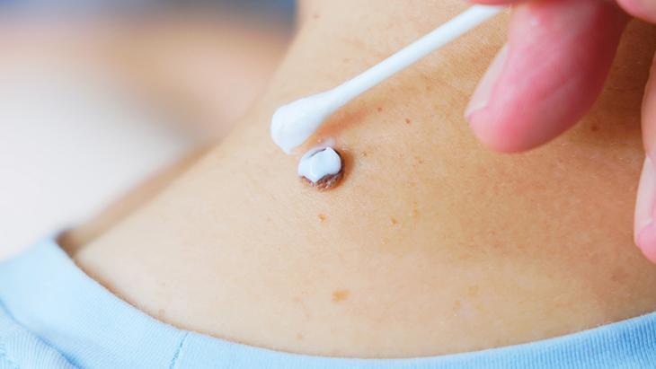 lazerle aldiran da var solusyon suren de her ben masum degil incelenmeli 3BJn8KS8.jpg